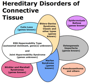 connective tissue disorder bubbles